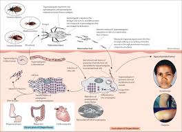 chagas-disease-43.jpeg