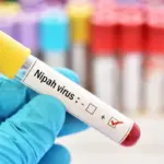 nipah-virus-symptoms-253.webp