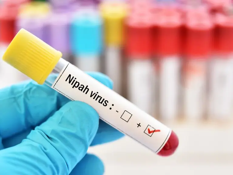 nipah-virus-symptoms-253.webp