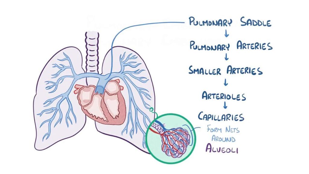 pulmonary-embolism-92.jpeg