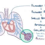 pulmonary-embolism-92.jpeg