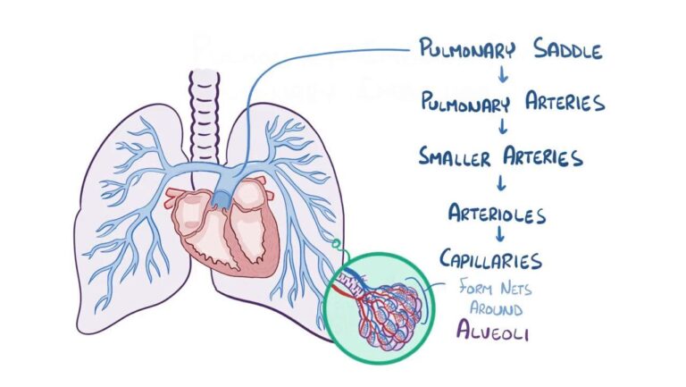 pulmonary-embolism-92.jpeg