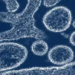 virus-nipah-1024.webp