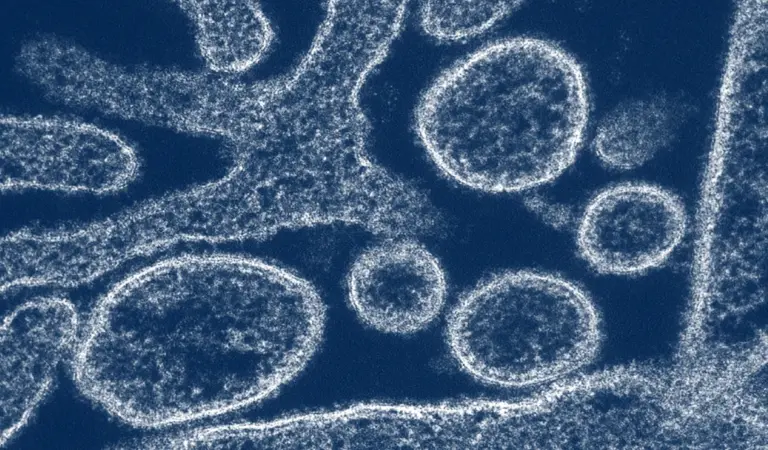 virus-nipah-1024.webp