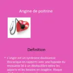 angine de poitrine — CA news