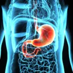 cancer — CA news